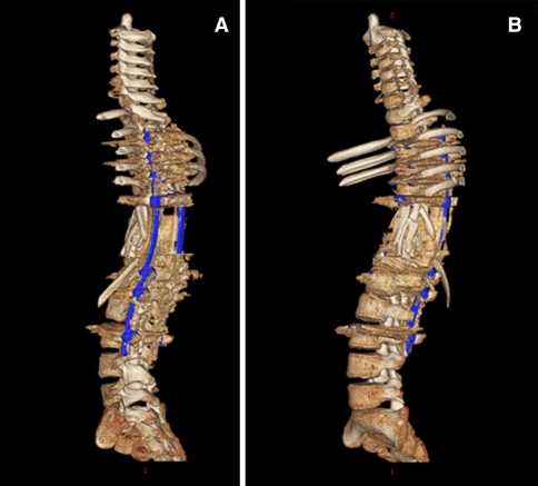 Fig. 11