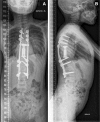 Fig. 12
