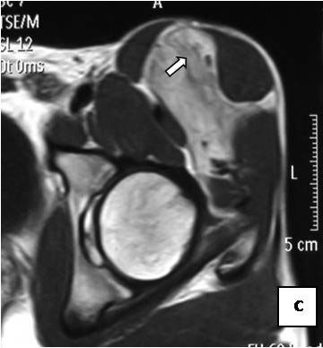 Figure 15