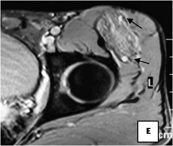 Figure 17