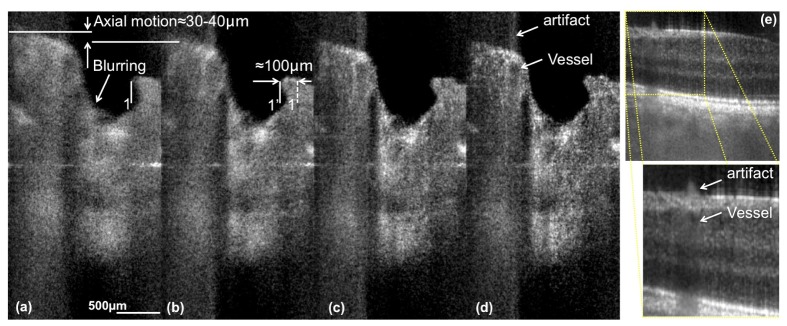 Fig. 11