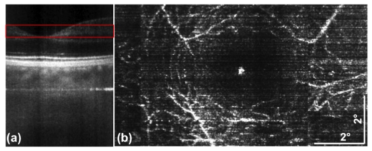 Fig. 10