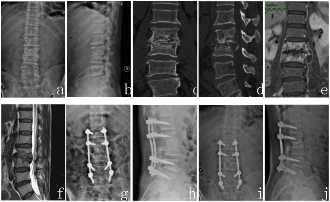 Fig 3