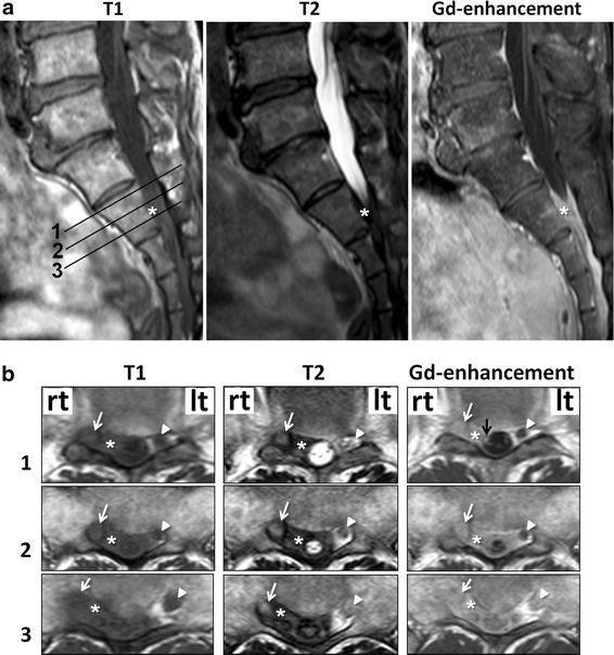 Fig. 1