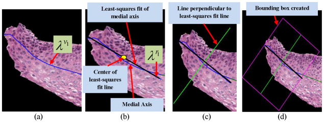 Fig. 14