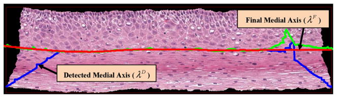 Fig. 12