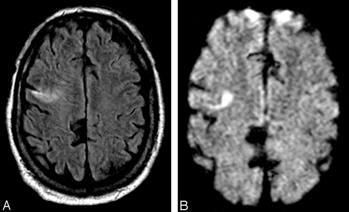 Fig 5.