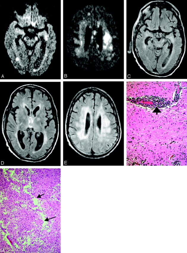 Fig 3.