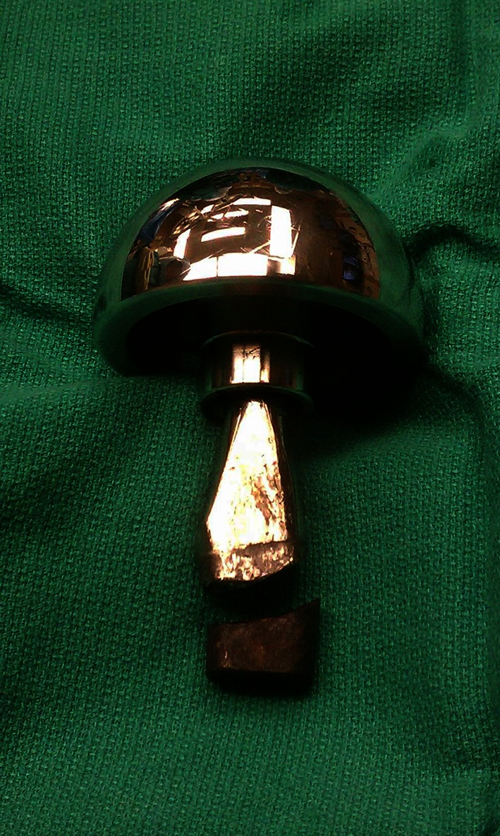 Fig. 2