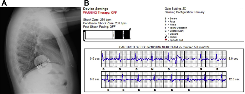 Figure 3