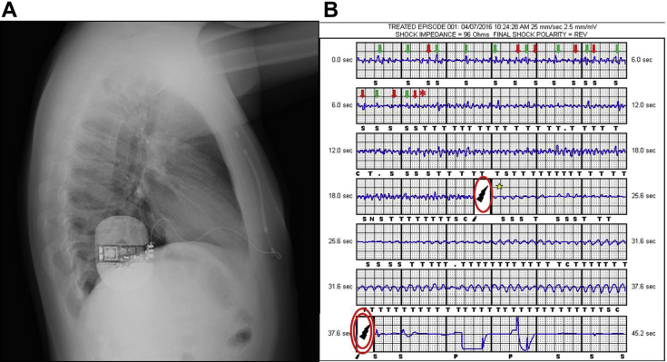 Figure 1