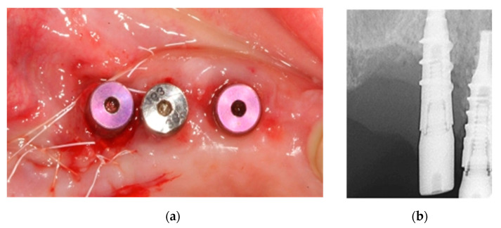 Figure 12
