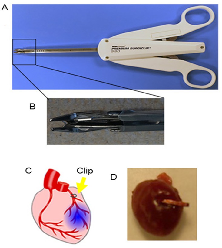 Fig 1