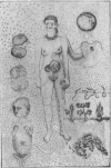 1585