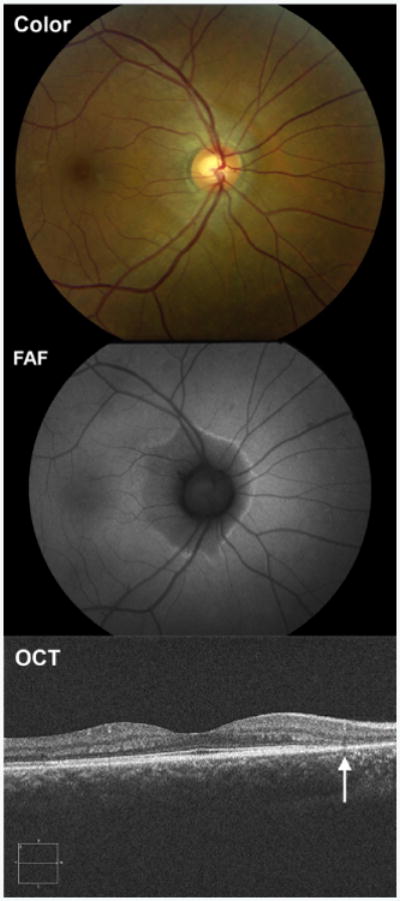 Figure 10