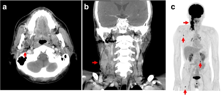 Fig. 1