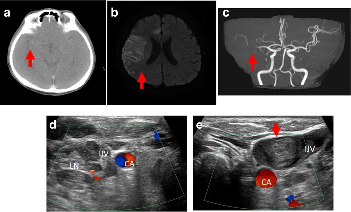 Fig. 2