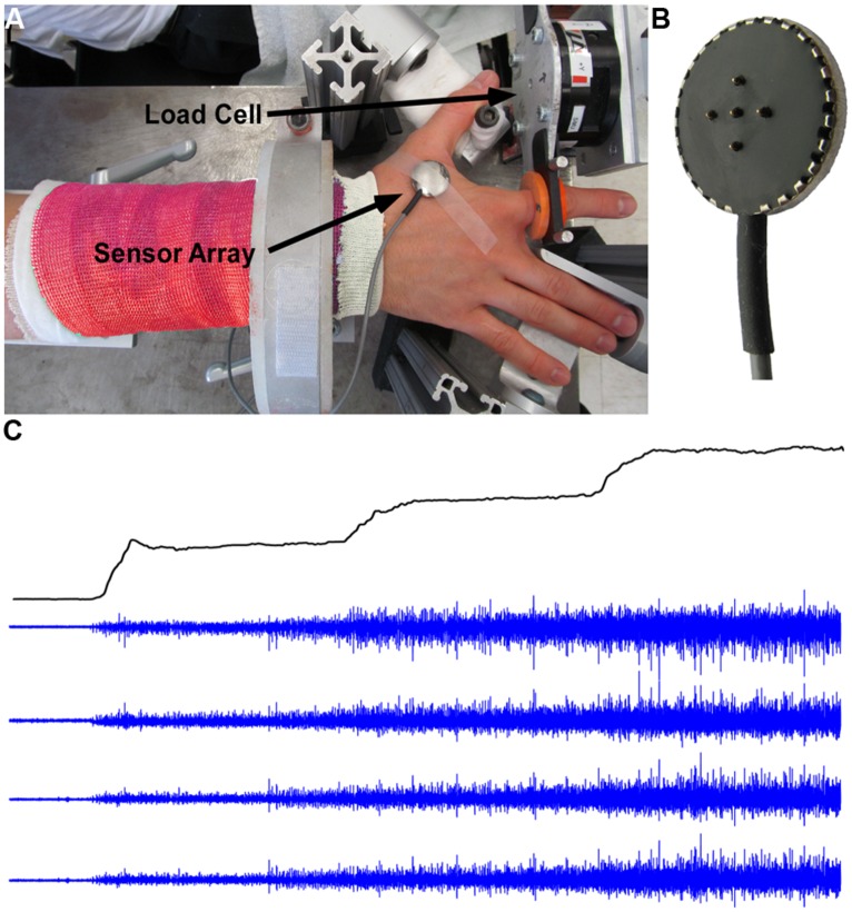 FIGURE 1