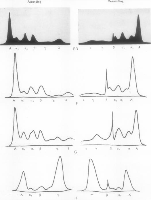 graphic file with name jclinpath00008-0030-a.jpg