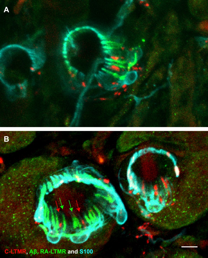 Figure 3—figure supplement 1.