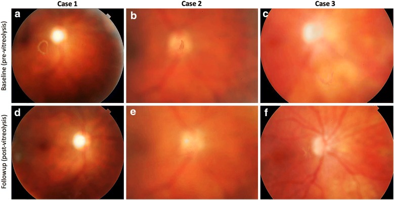 Fig. 1