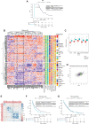 Figure 3. Clinicopathologic and genomic characteristics of extreme responders to palbociclib plus ET. A, PFS analysis in extreme responder patients (sensitive vs. refractory), under palbociclib plus ET treatment. B, Unsupervised hierarchical clustering complete linkage and euclidean distance of n = 229 patients treated with palbociclib plus ET according to 51 differentially expressed significant genes by SAM analysis (FDR < 0.05), in refractory versus sensitive tumors (each row represents a patient, and each column a gene). Also includes the measure of proliferation by Ki67, as well as the clinical subtype classification of patients in LumA, LumB, and non-luminal, the presence of ESR1 mutations, the presence of one or multiple metastases and the type of response to treatment. C, Boxplot showing mRNA expression levels of PLK1 and CCNE1 according to tumors subtype and source of tissue in the whole biomarker cohort (D) Correlation plot between mRNA expression levels of PLK1 and CCNE1 in the whole biomarker cohort. E, Correlation matrix and unsupervised hierarchical clustering (complete linkage and euclidean distance of the 51 differentially expressed genes in refractory versus sensitive tumors to palbociclib plus ET. PFS analysis according to levels of mRNA PLK1 in patients treated with (F) palbociclib or (G) capecitabine. In PFS curves, Kaplan–Meier plots are used to represent the survival curves, while Cox models, adjusted by prognosis variables, are used to represent the values. LowExpr PLK1 (below median value); HighExpr PLK1 (above median value); Median value = 8.380255. Sensitive: PFS in the upper quartile; Refractory: PFS in the lower quartile.