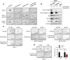 Figure 4. Breast cancer cells resistant to palbociclib and ET depend on PLK1 expression for tumor growth. A, Representative images of crystal violet stained cell monolayers of parental MCF7, PalboR (palbociclib resistant) or FPR (fulvestrant – palbociclib resistant) treated with the indicated drugs at 1 μmol/L final concentration, every 72 hours for 21 days. B, Western blot analysis for p-Rb (Ser780), p-Rb (Ser807/811), Rb, ER-α, Plk1 of whole cell lysates from MCF7 parental or resistant cells treated with vehicle, palbociclib alone or in combination with fulvestrant at 1 μmol/L final concentration for 72 hours. Β-actin was used as a loading control. Images are representatives from three independent experiments. C, Representative images of breast tumor spheroids from MCF7, MCF7-PalboR or -FPR transfected with 40 nmol/L siRNA scrambled (siCTRL) or siRNA versus PLK1 mRNA (siPLK1) for 48 hours and treated with vehicle (DMSO), 1μmol/L of fulvestrant ± 1μmol/L of palbociclib for other 6 days, every 72 hours. All images were capture at 20X magnification (Bars = 200 μm). D, Representative images of breast tumor spheroids from MCF7-CTRL or PLK1-overexpressing cells treated for 6 days with 1 μmol/L fulvestrant + palbociclib. Images are representatives from three independent experiments.