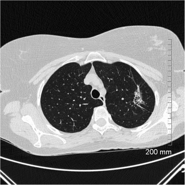 Fig. 15