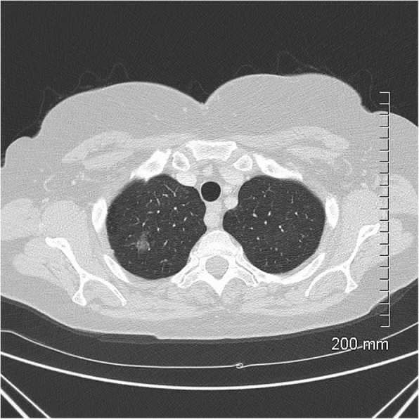 Fig. 11