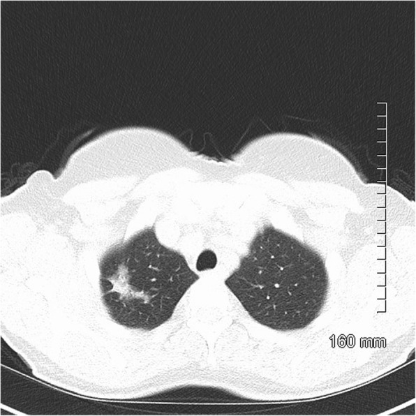 Fig. 16