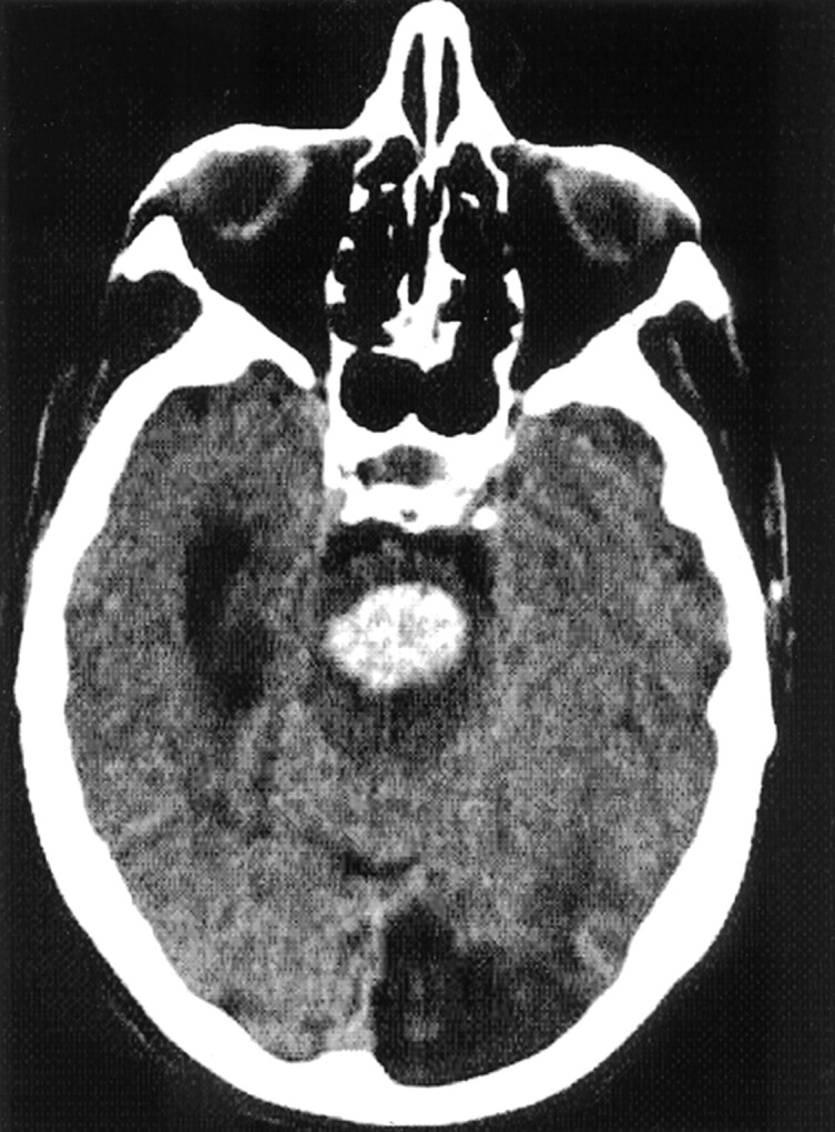 Fig 2.