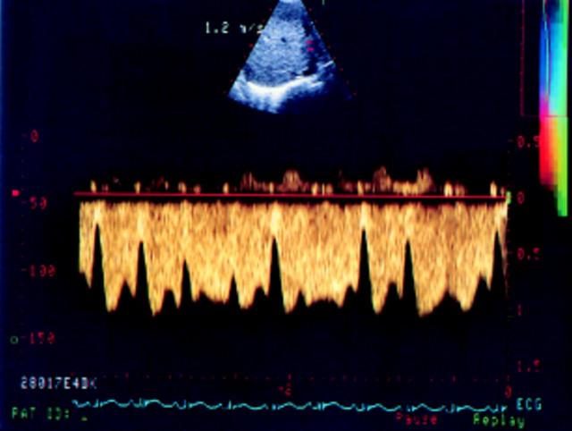 Figure 3  