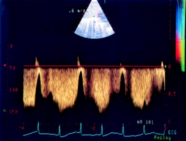 Figure 4  