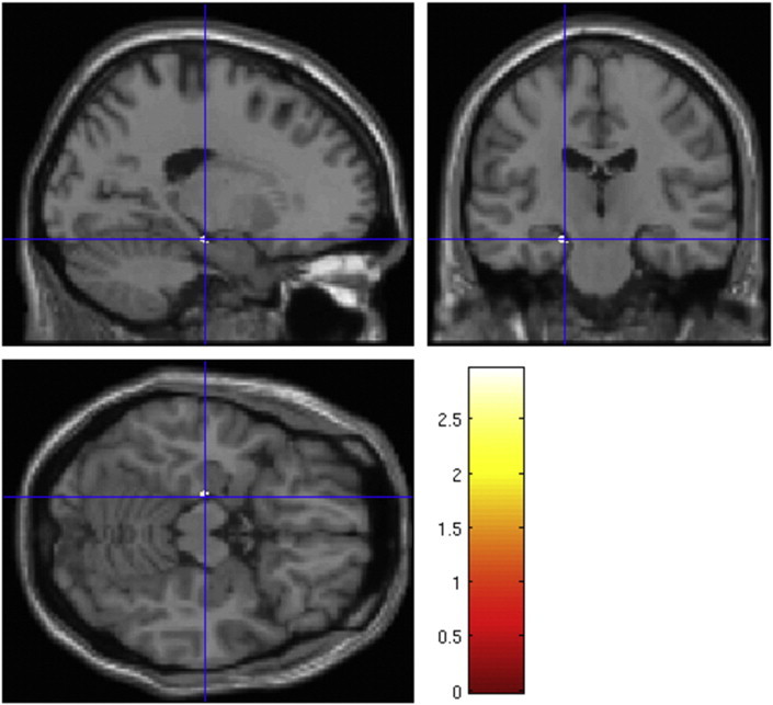 Fig. 1