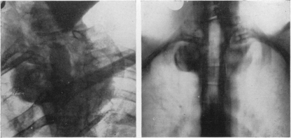 Fig. 4 (a) and (b)