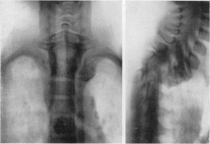 Fig. 2 (c) and (d)