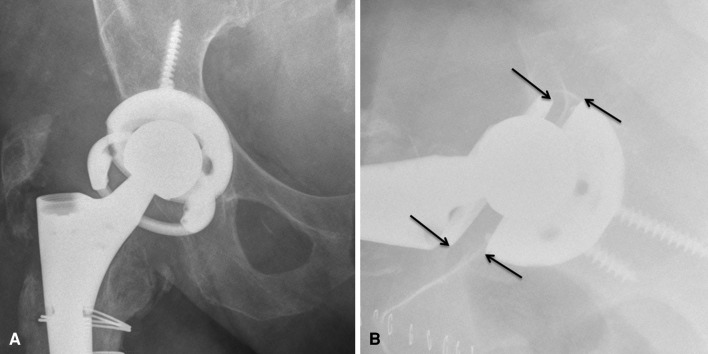 Fig. 3A–B