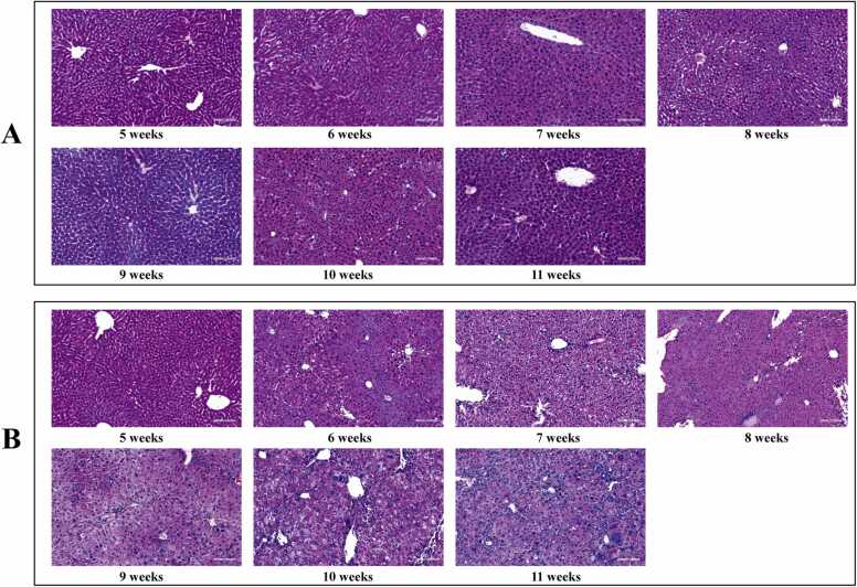 Early warning and diagnosis of liver cancer based on dynamic network