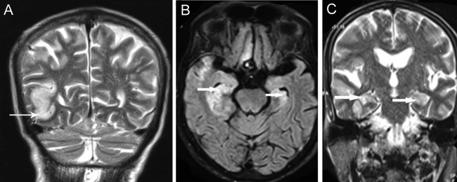 Figure 2