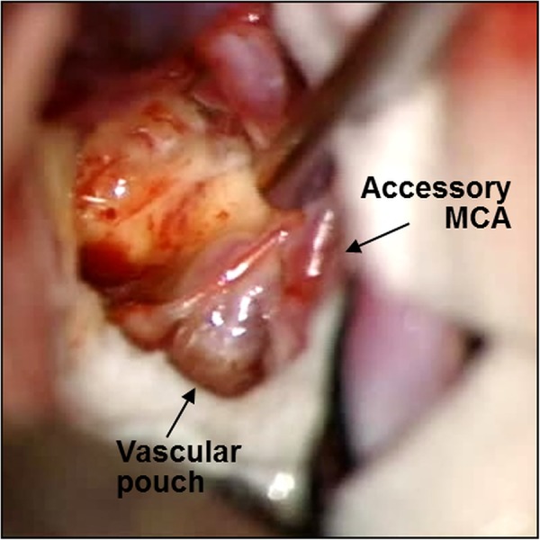 Figure 3