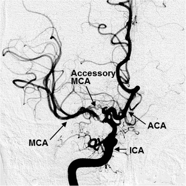 Figure 5