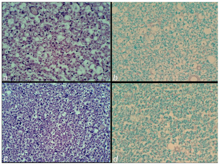 Figure 14