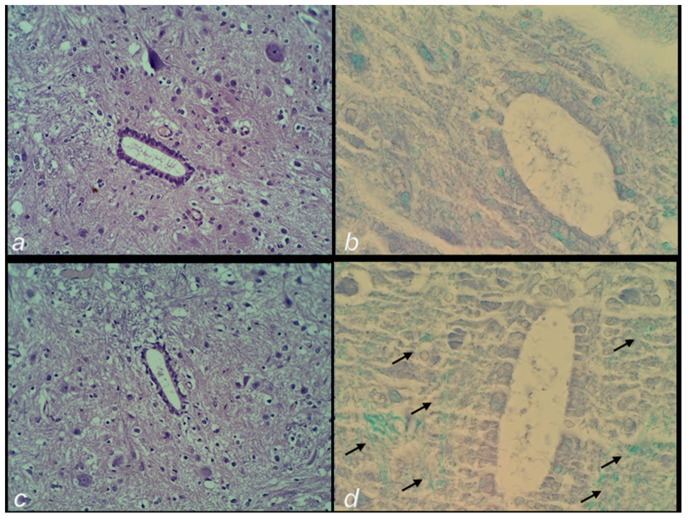 Figure 13
