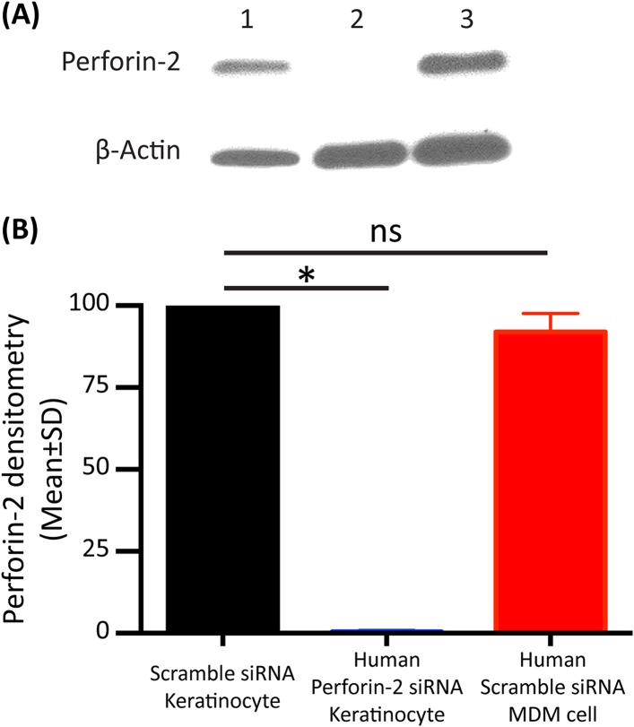 Figure 3—figure supplement 2.