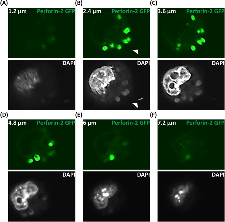 Figure 4—figure supplement 2.