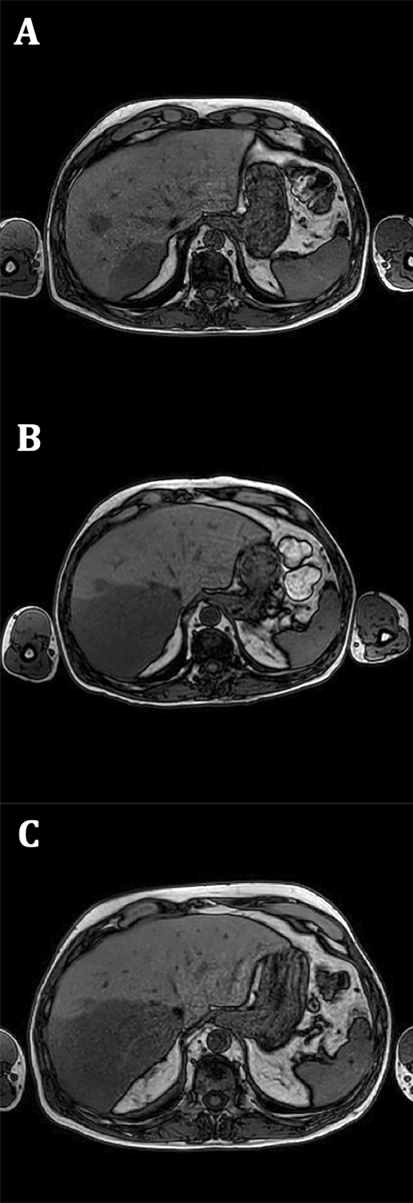 Fig. 2