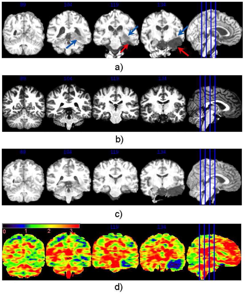 Fig. 13