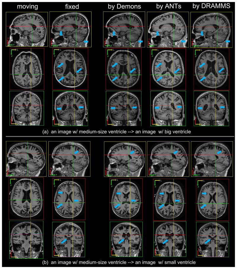 Fig. 11