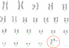 Figure 1A