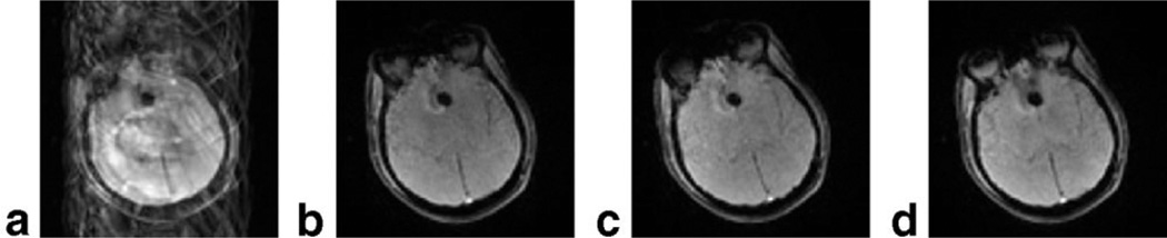 FIG. 6